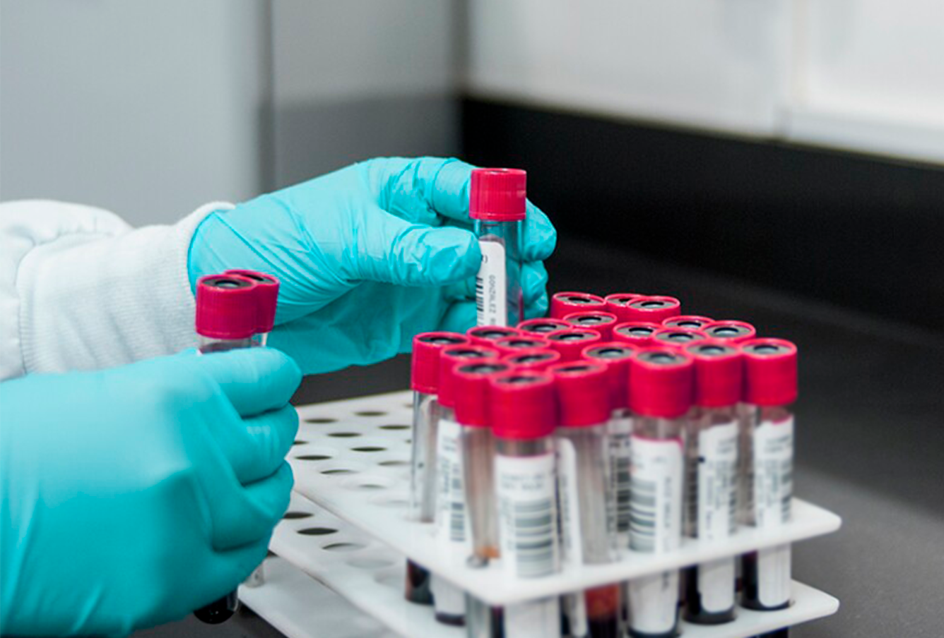 Exámenes de Laboratorio